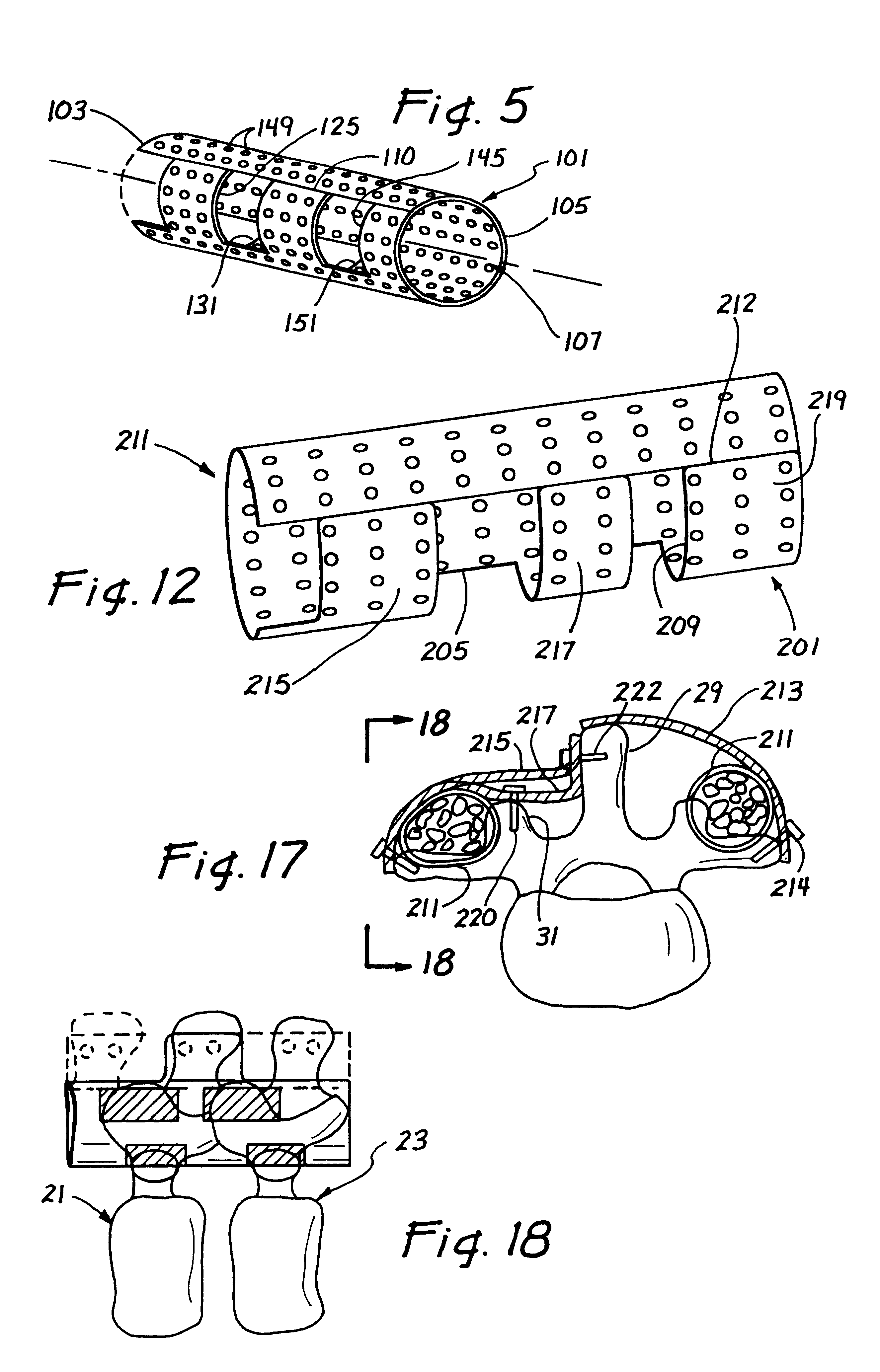 Resorbable posterior spinal fusion system