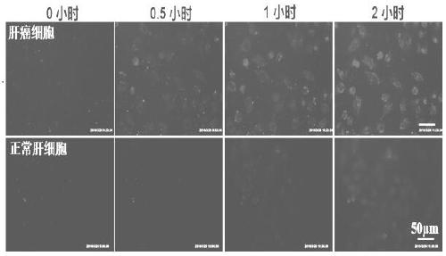 Dual-response nanodrug delivery system loaded with antitumor drugs for tumor therapy and preparation method of nanodrug delivery system