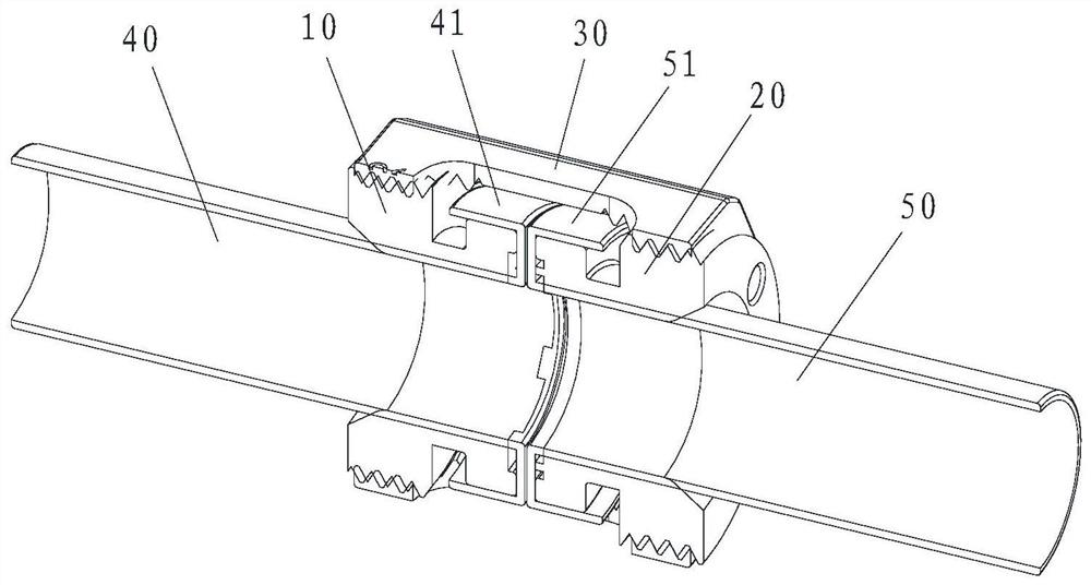 Biodegradable rapid blood vessel anastomosis device