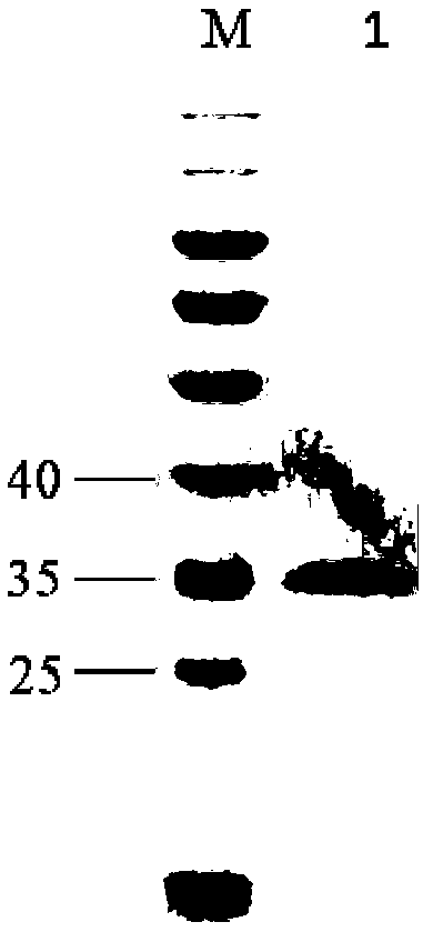 Secretory expression method of carboxypeptidase B