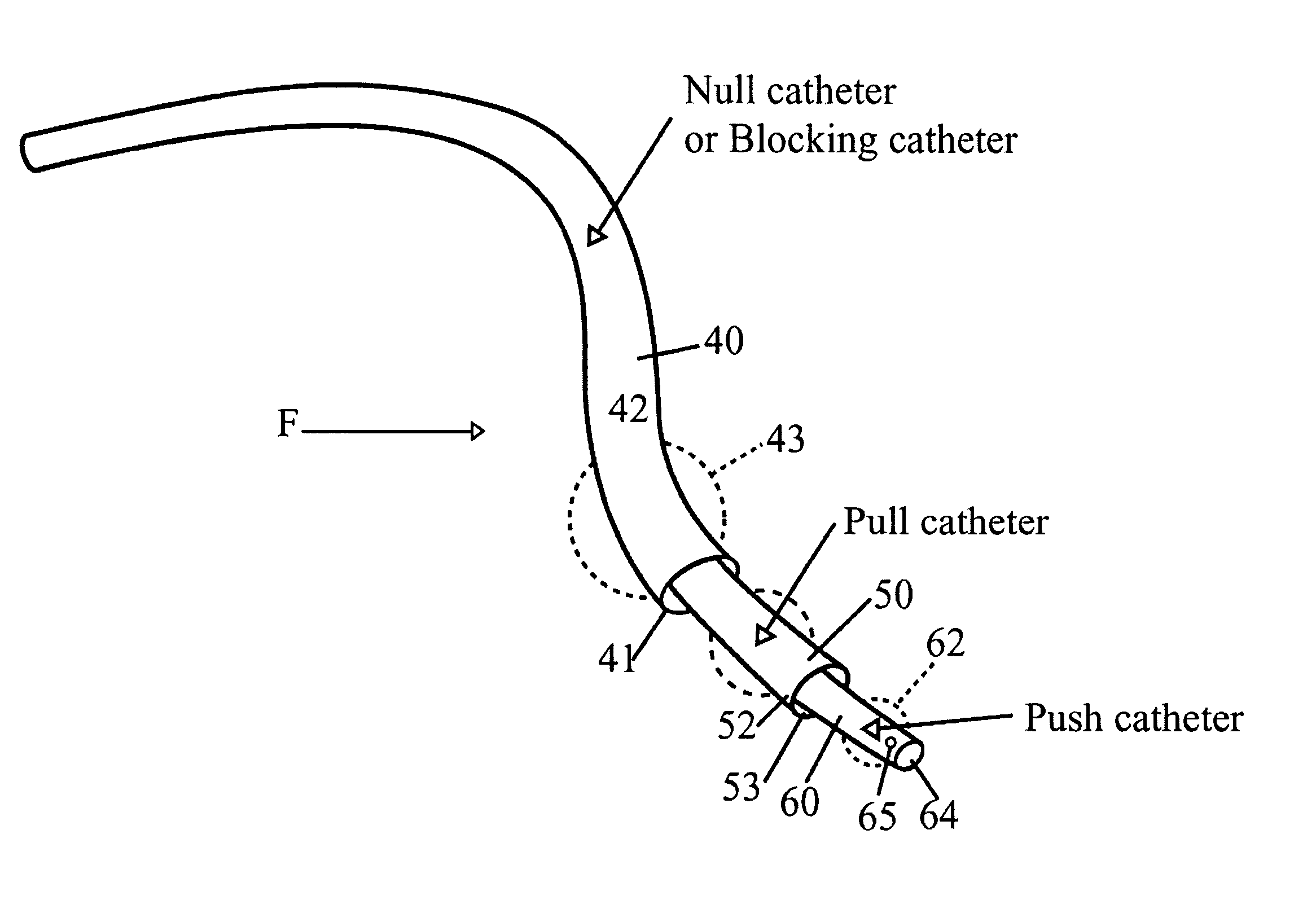 Computerized system for monitored retrograde perfusion of tumor sites