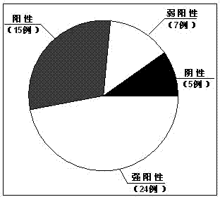 Application of DJ-1 protein in preparation of product for diagnosis and therapy of osteosarcoma