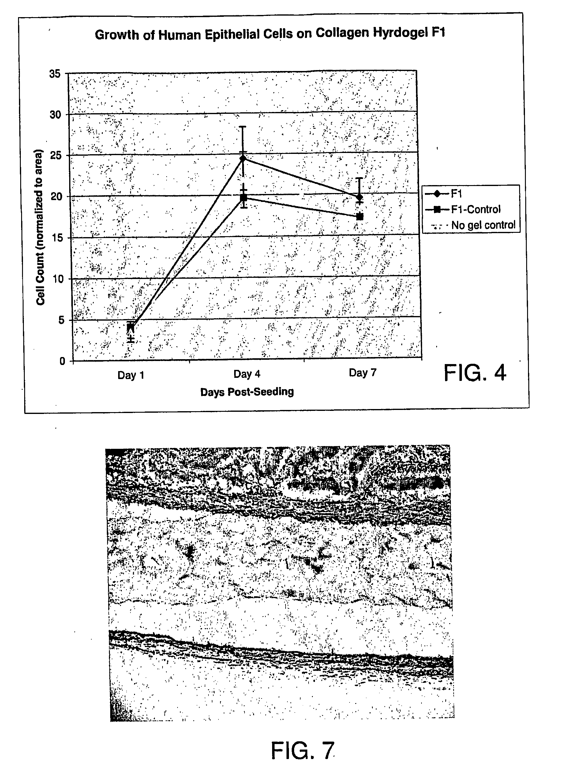 Ophthalmic Device and Related Methods and Compositions