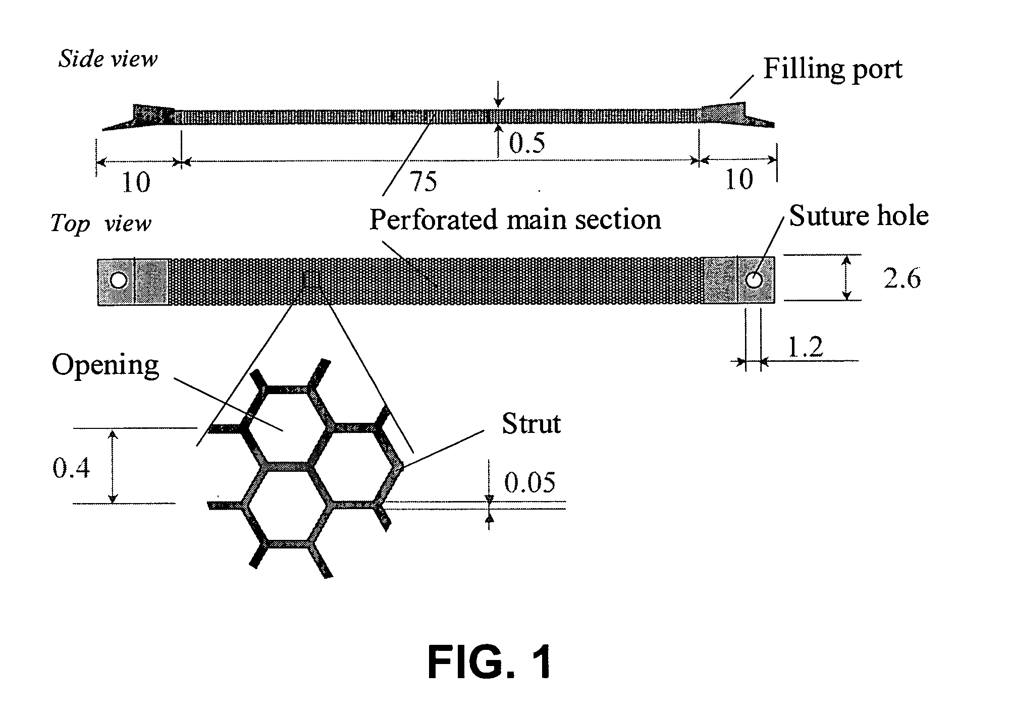 Bio-artificial pancreas and a procedure for preparation of same