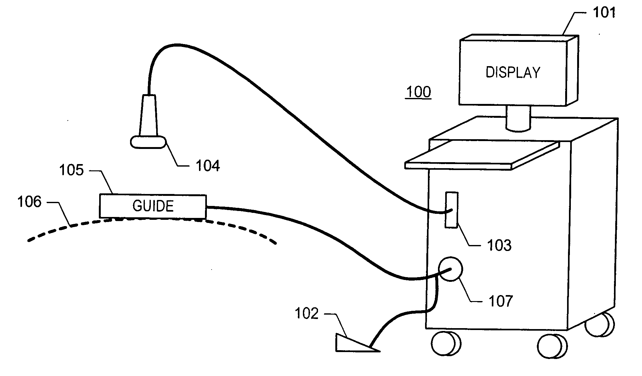 Ultrasound image acquisition guiding device and method