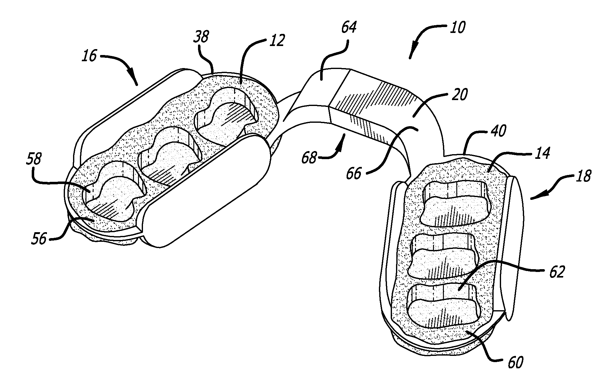 Mouthpiece