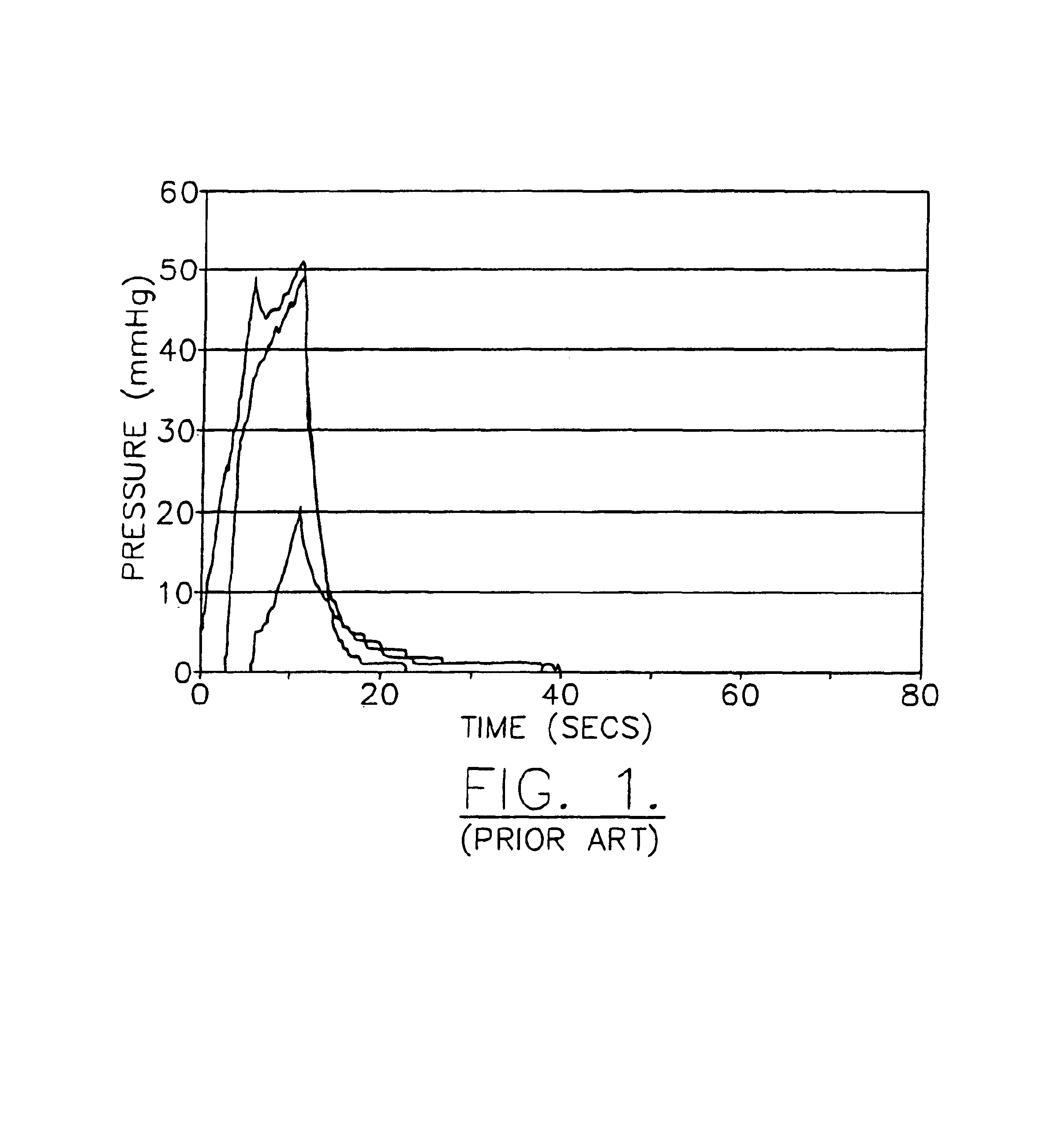Universal connecting device that designates an operational mode