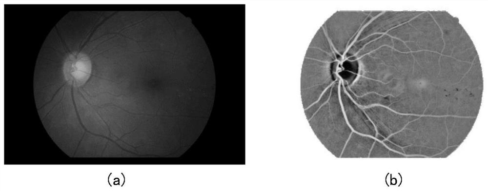 Fundus image microhemangioma detection device and method thereof and storage medium