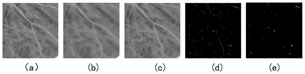 Fundus image microhemangioma detection device and method thereof and storage medium