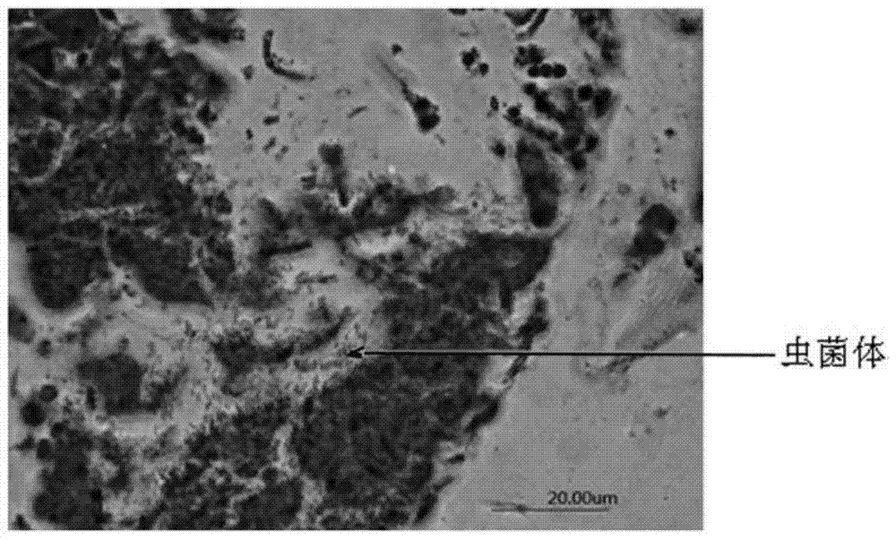 An Improved Grocott Hexamine Silver Staining Method and Its Application