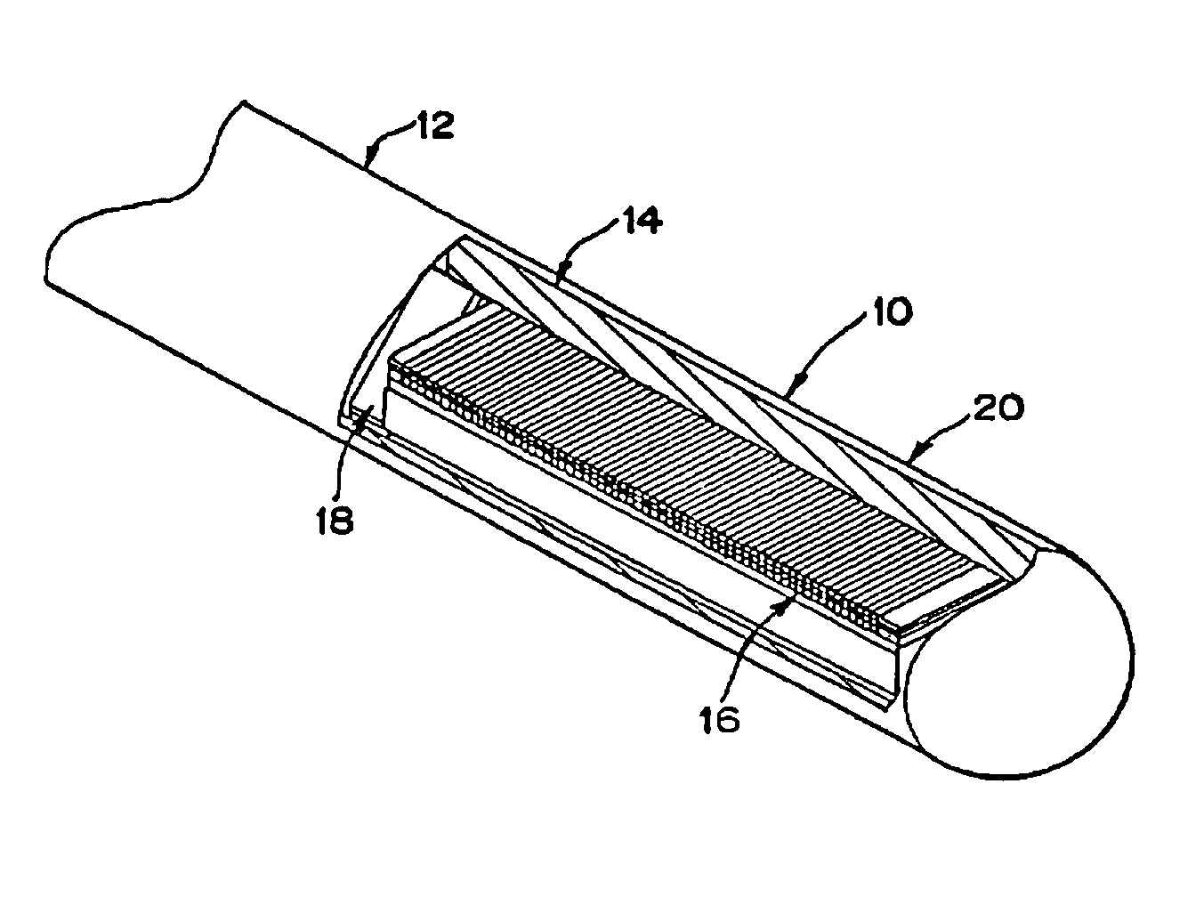 Medical diagnostic ultrasound catheter with dielectric isolation
