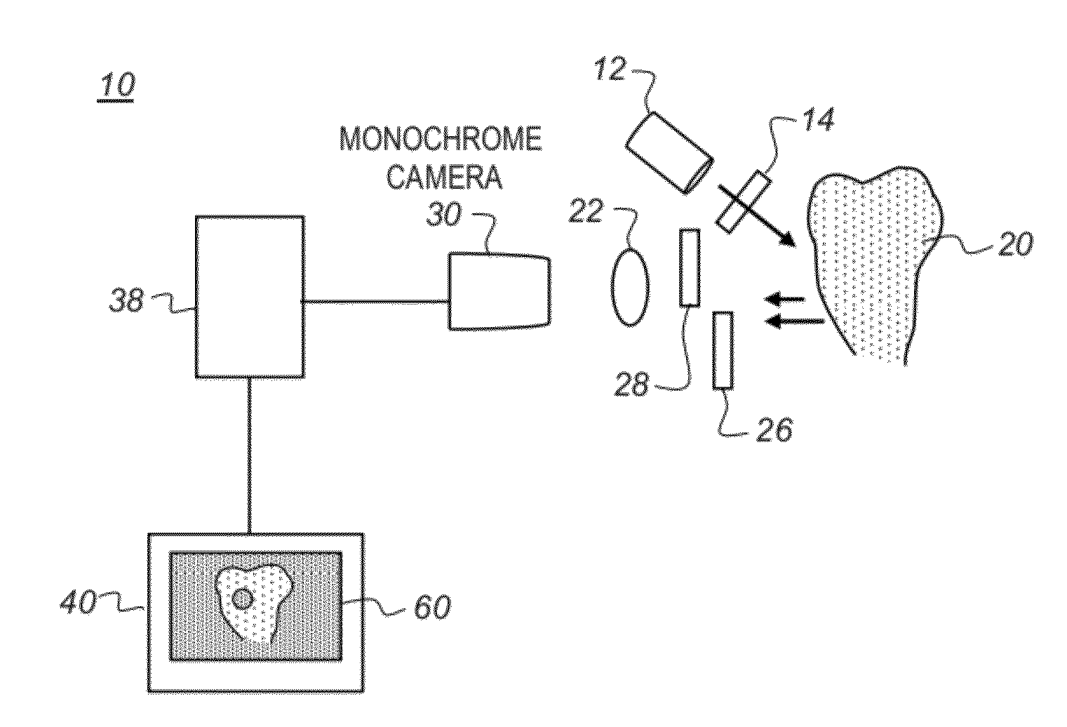 Apparatus and method for caries detection