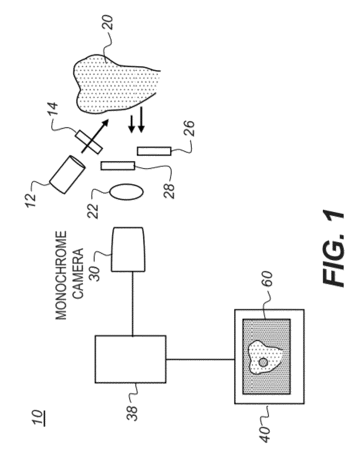 Apparatus and method for caries detection