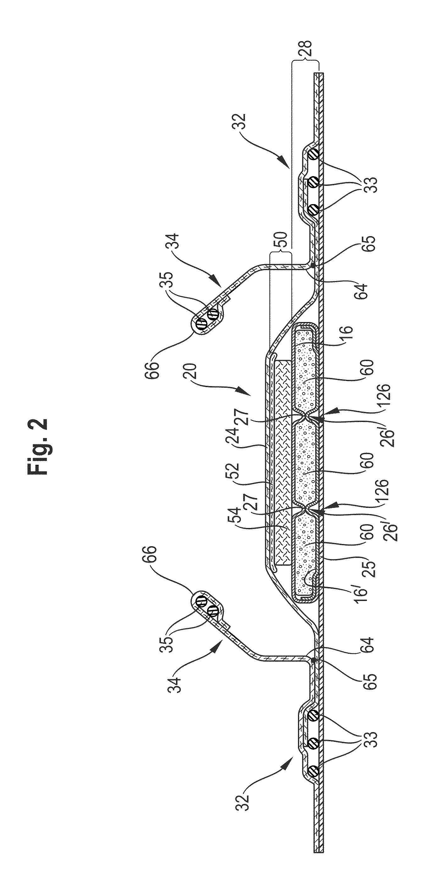 Absorbent article comprising one or more colored areas