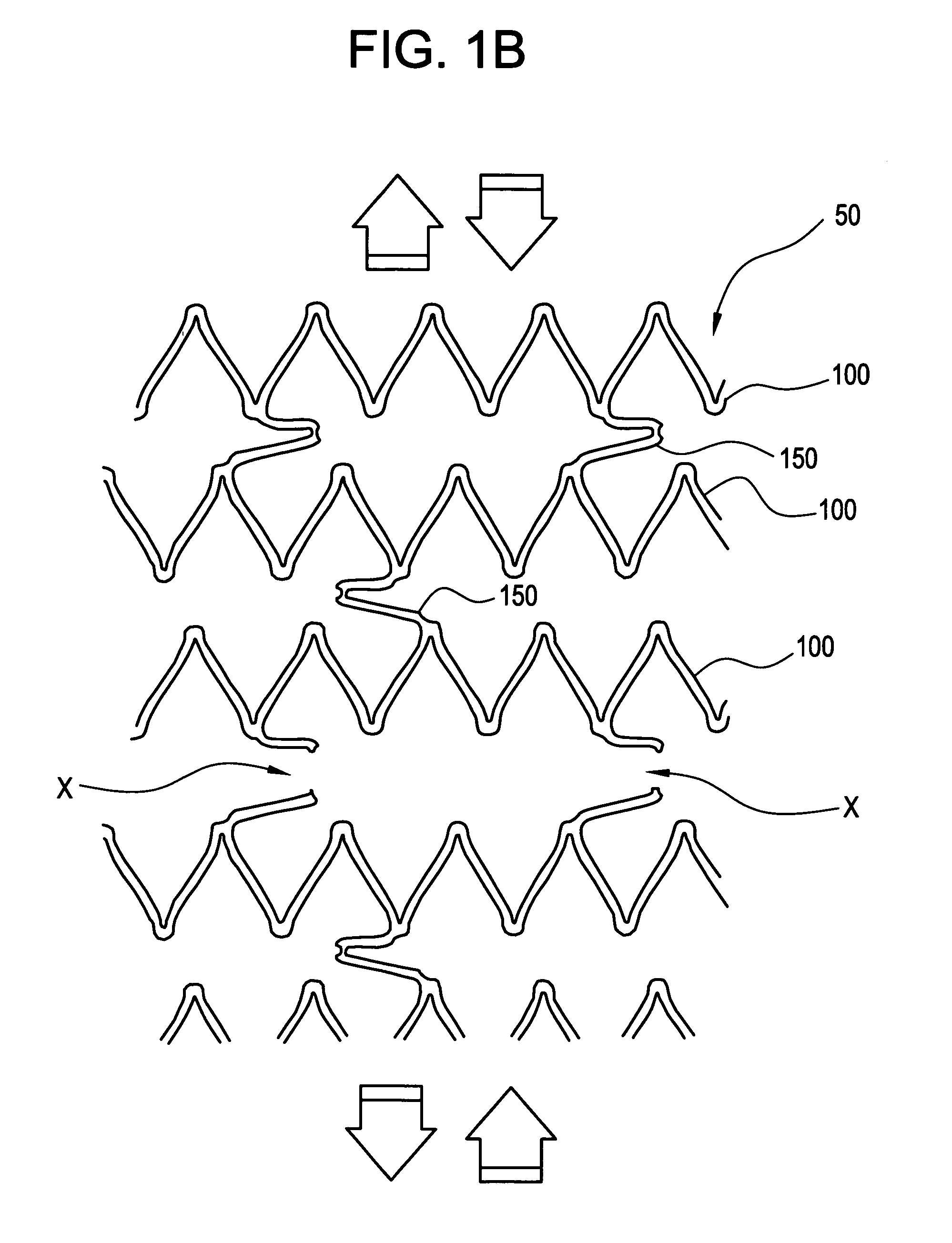 Intraluminal medical device with strain concentrating bridge