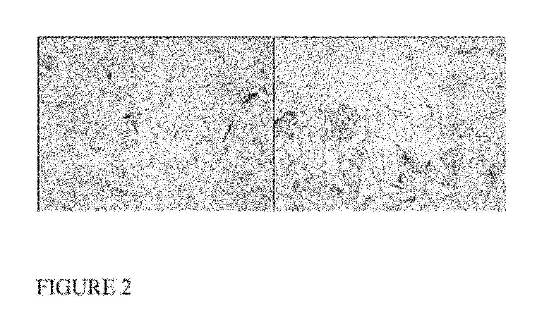 Interconnected porous non-degradable poly(VINYL) alcohol implant and method of manufacture