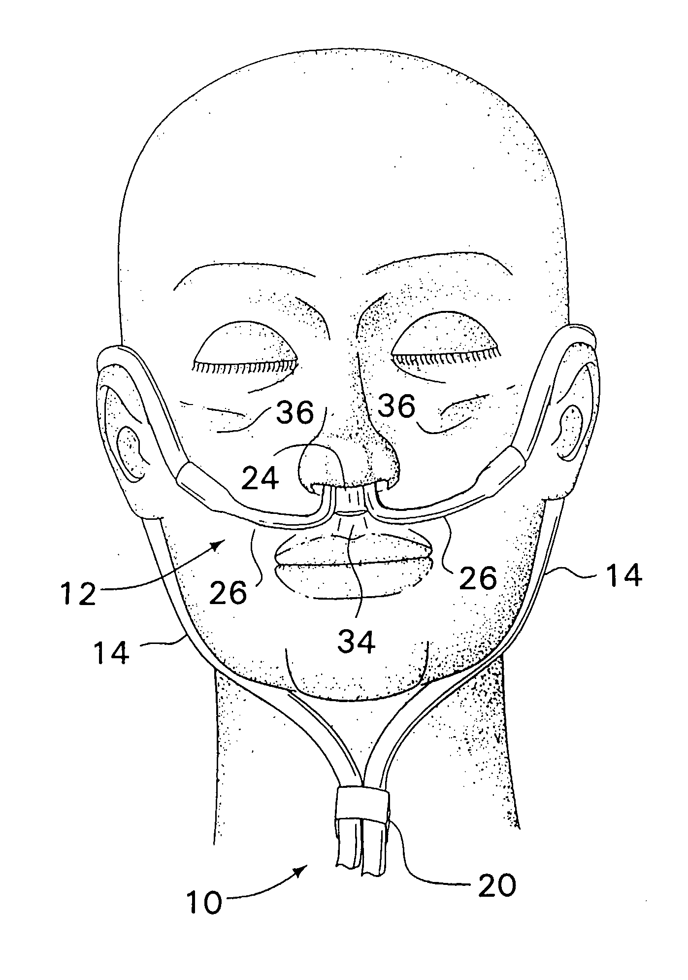 Respiratory Therapy System Including a Nasal Cannula Assembly