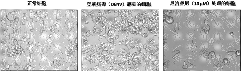 Nilotinib as medicine for treating dengue virus infection and pharmaceutical application thereof
