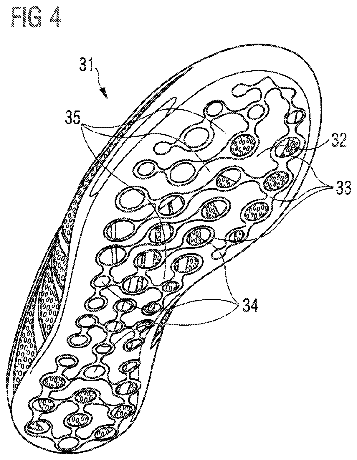 Baseplate for a shoe