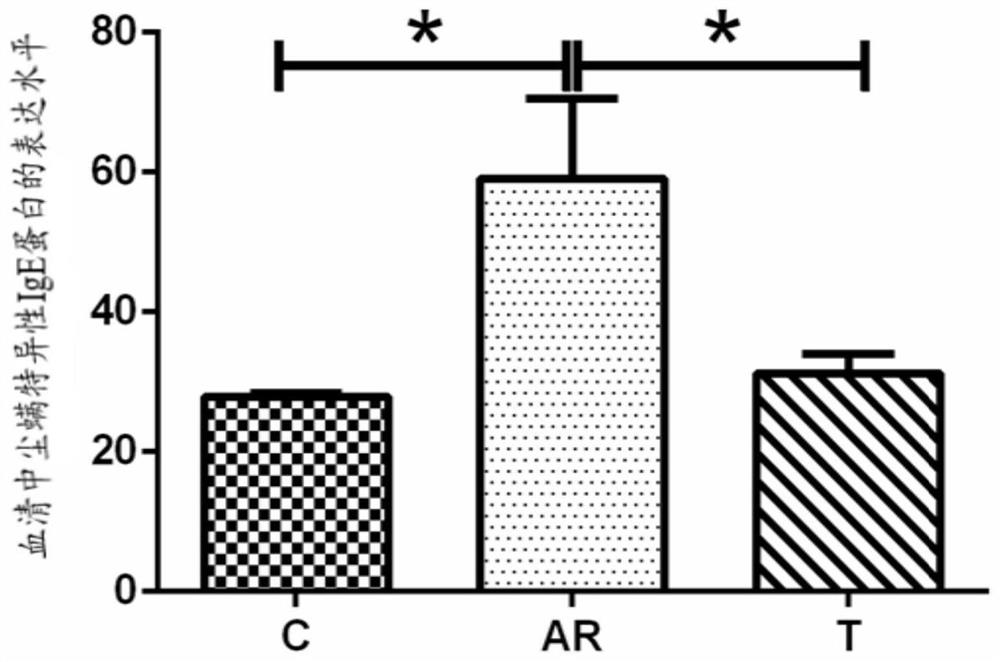 Application of miR-124-3p agonist to preparation of IL4R alpha protein expression inhibitor