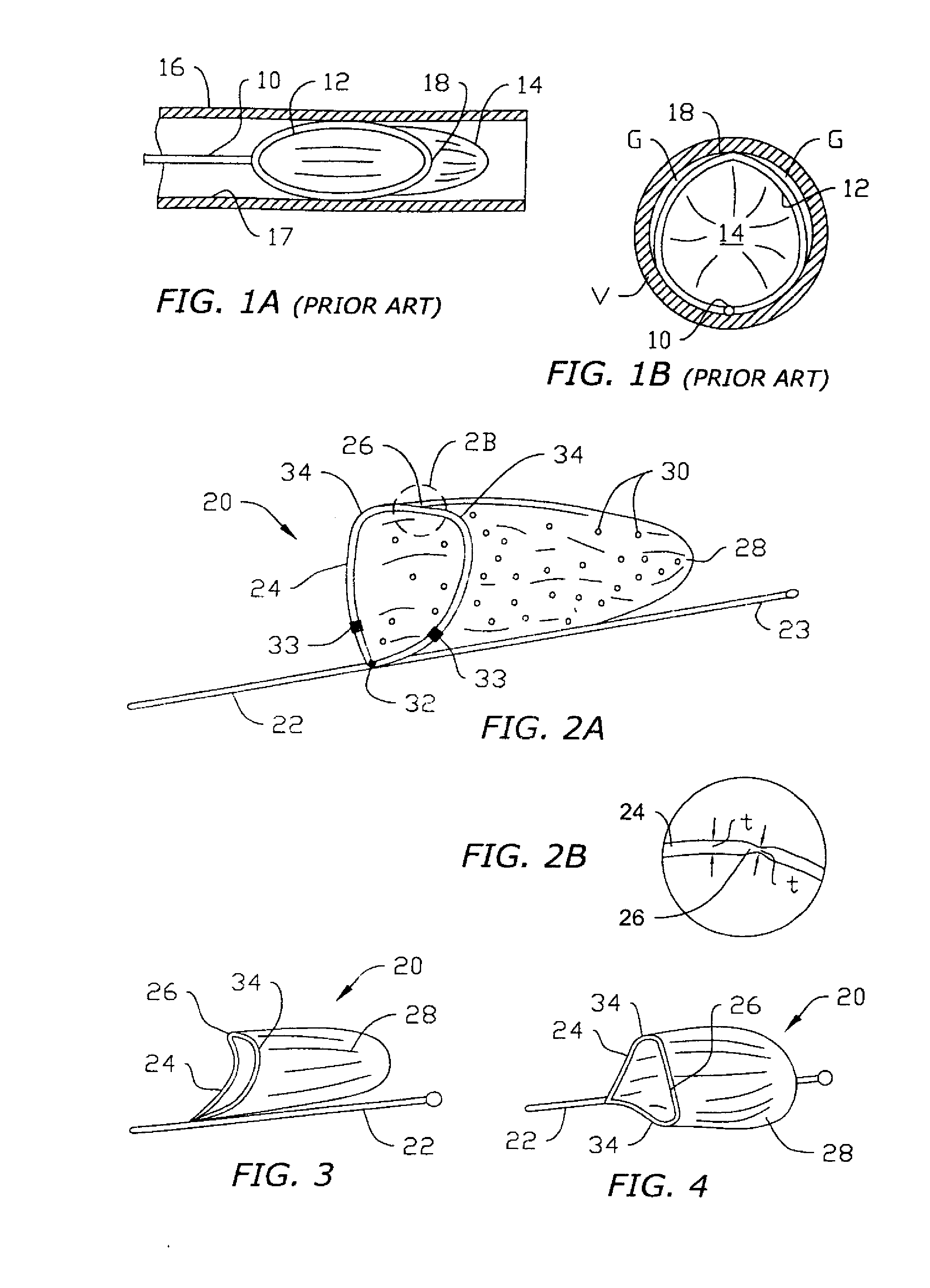 Vasculara device for emboli, thrombus and foreign body removal and methods of use