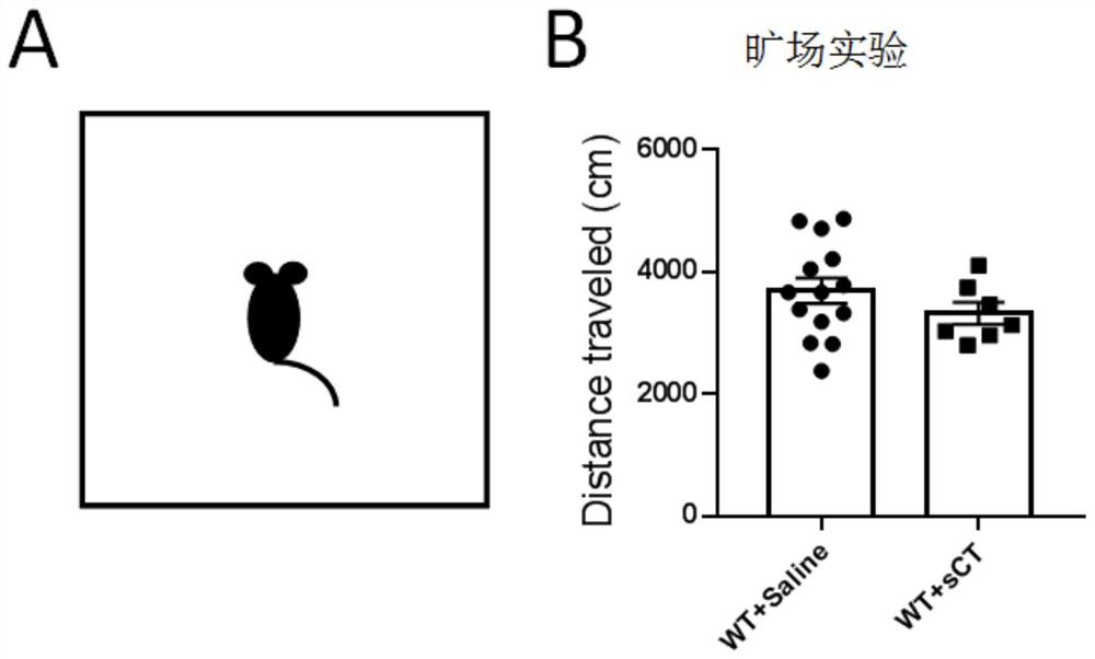 Application of salmon calcitonin in preparation of drugs for treating depression