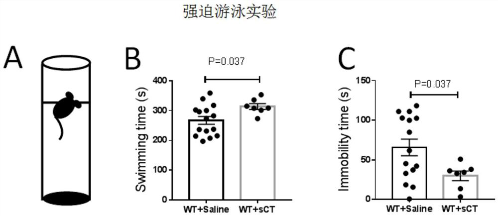 Application of salmon calcitonin in preparation of drugs for treating depression