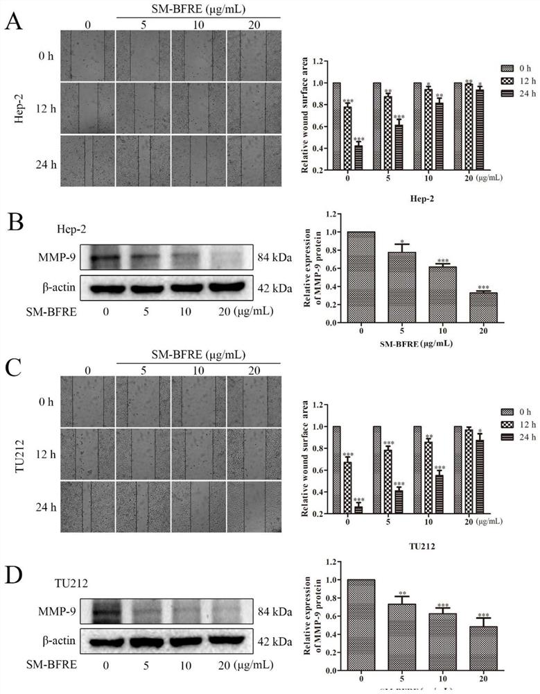 Pharmaceutical composition for treating laryngeal cancer, its preparation method and application