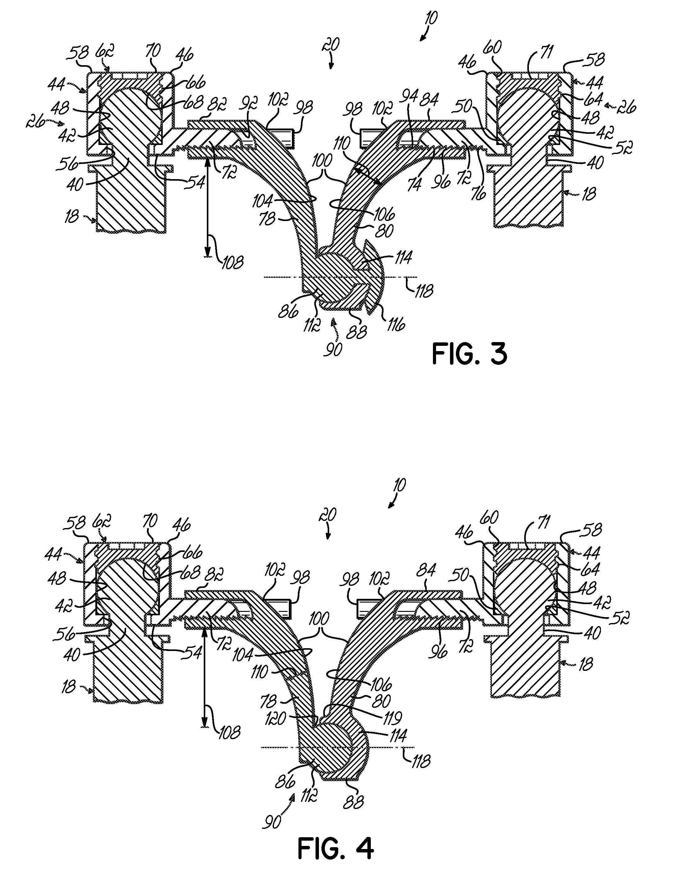 Dynamic spinal stabilization system and method of using the same