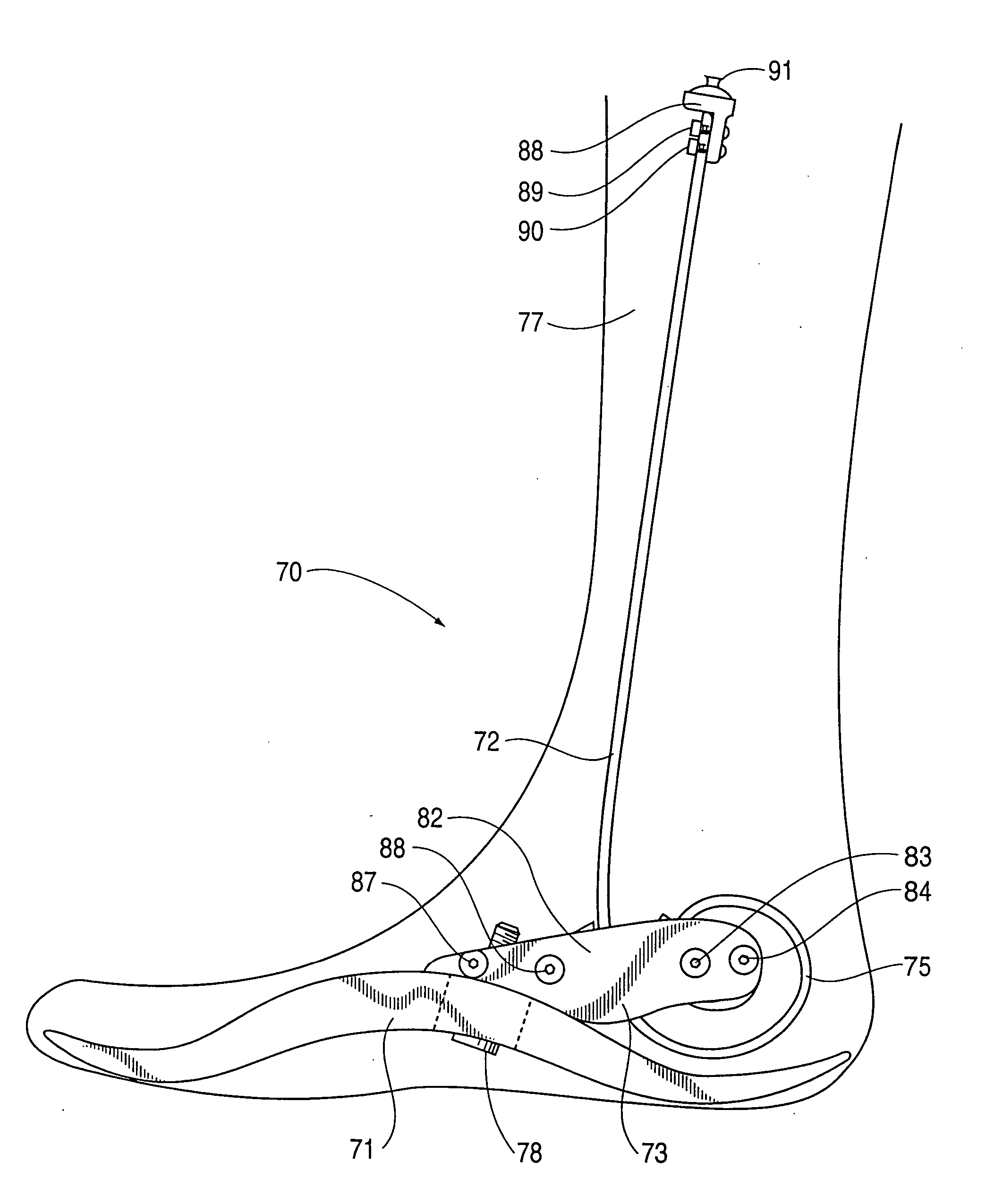 Prosthetic foot with tunable performance