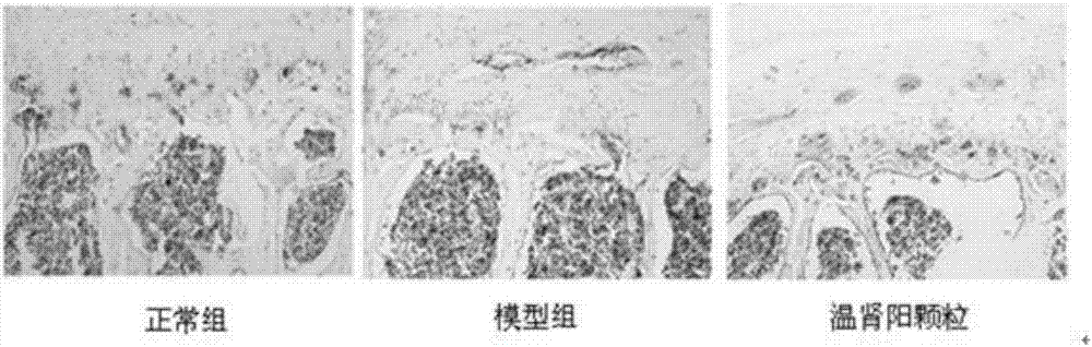 Chinese herbal medicine compound preparation for treating primary osteoporosis and preparation method thereof