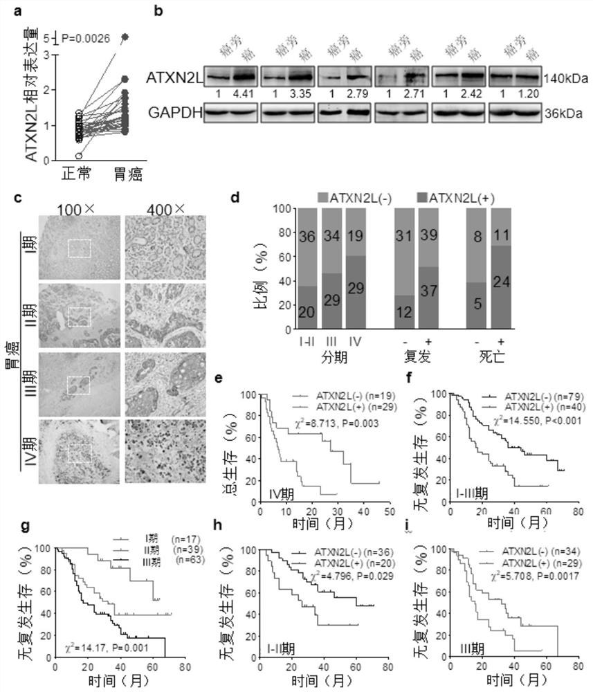 Use of atxn2l for preparing medicines for reversing gastric cancer oxaliplatin drug resistance