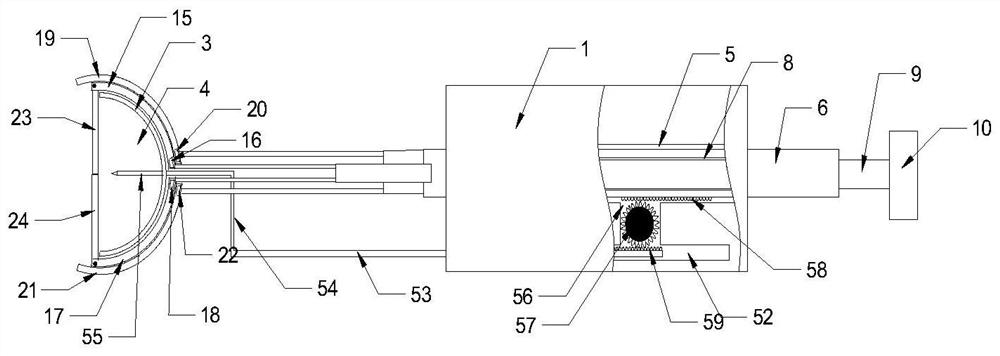 Novel clinical calculus removing device for hepatobiliary surgery department