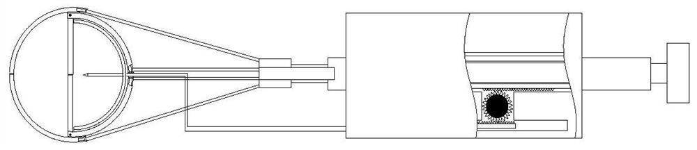 Novel clinical calculus removing device for hepatobiliary surgery department