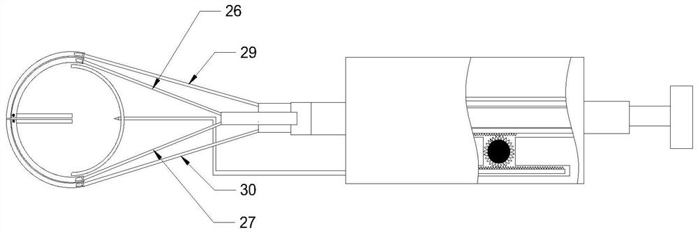 Novel clinical calculus removing device for hepatobiliary surgery department