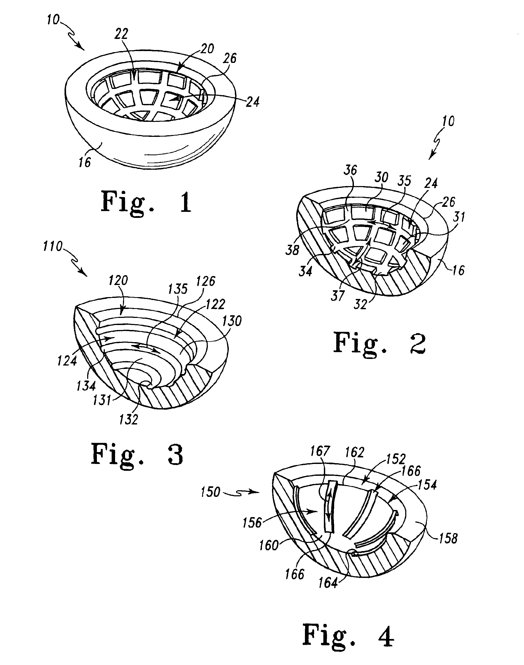 Prosthetic joints having reduced area bearing surfaces and application thereof to a range of sizes of prosthetic joints