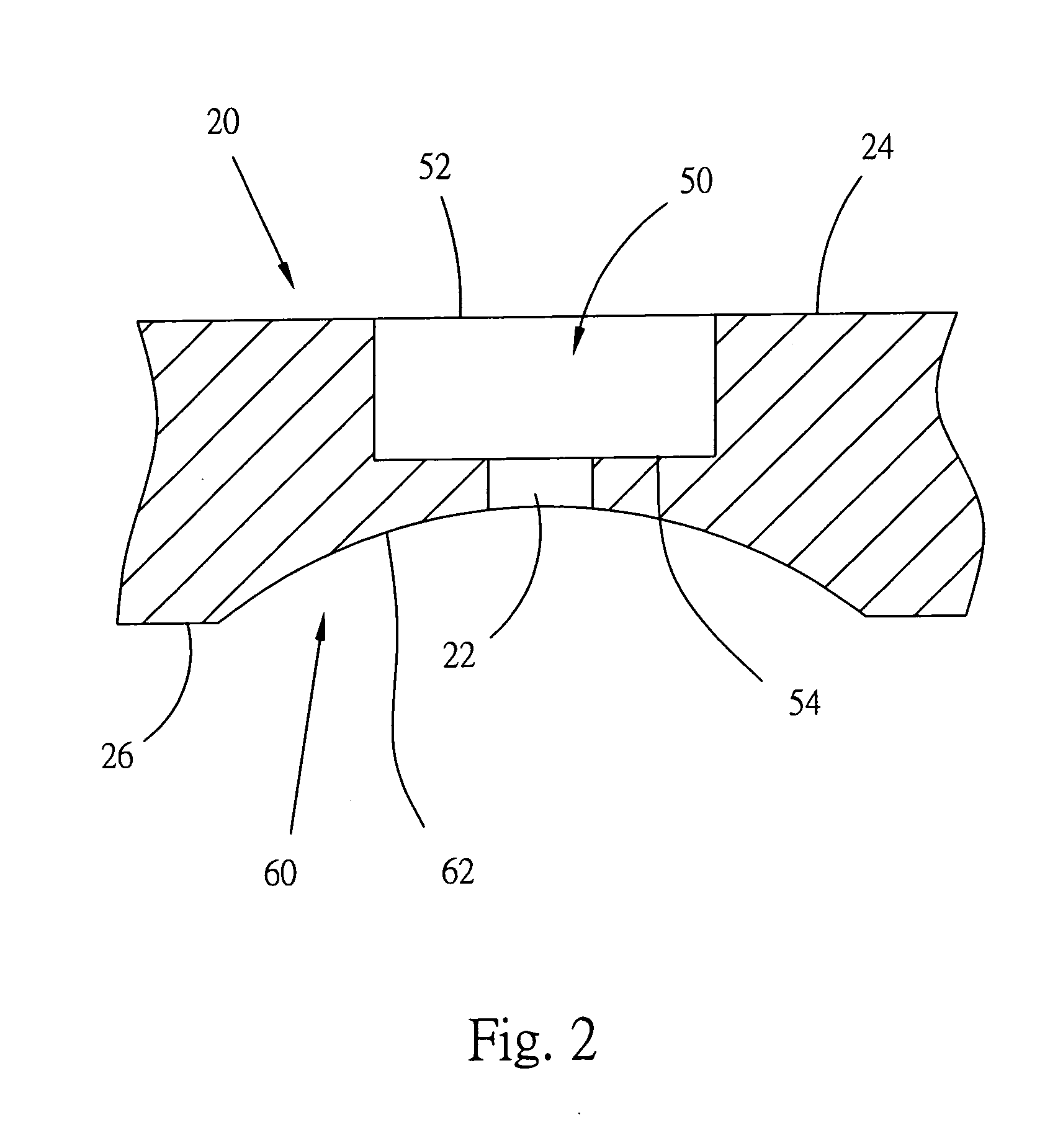 Atomizing nozzle with enhanced structural strength