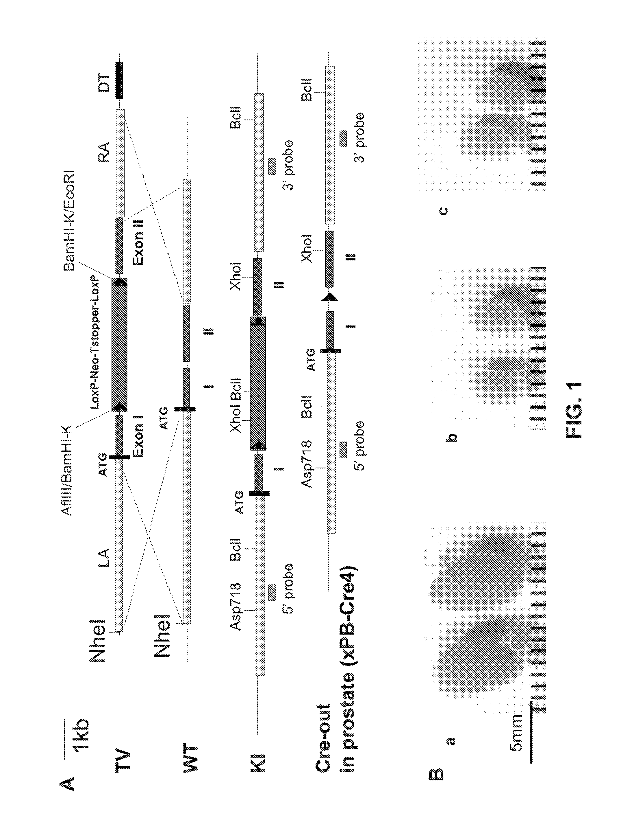 Signatures and determinants associated with prostate cancer progression and methods of use thereof