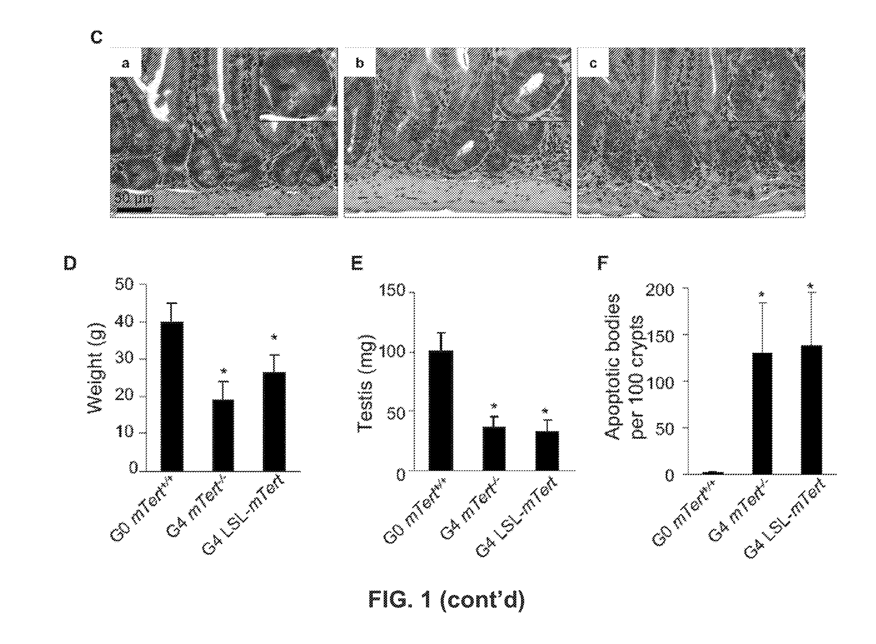 Signatures and determinants associated with prostate cancer progression and methods of use thereof