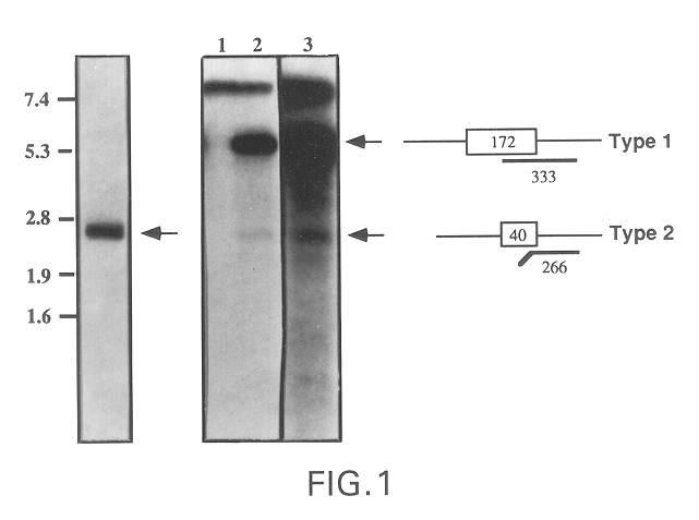 Acid sphingomyelinase protein and methods of treating type B Niemann-Pick disease