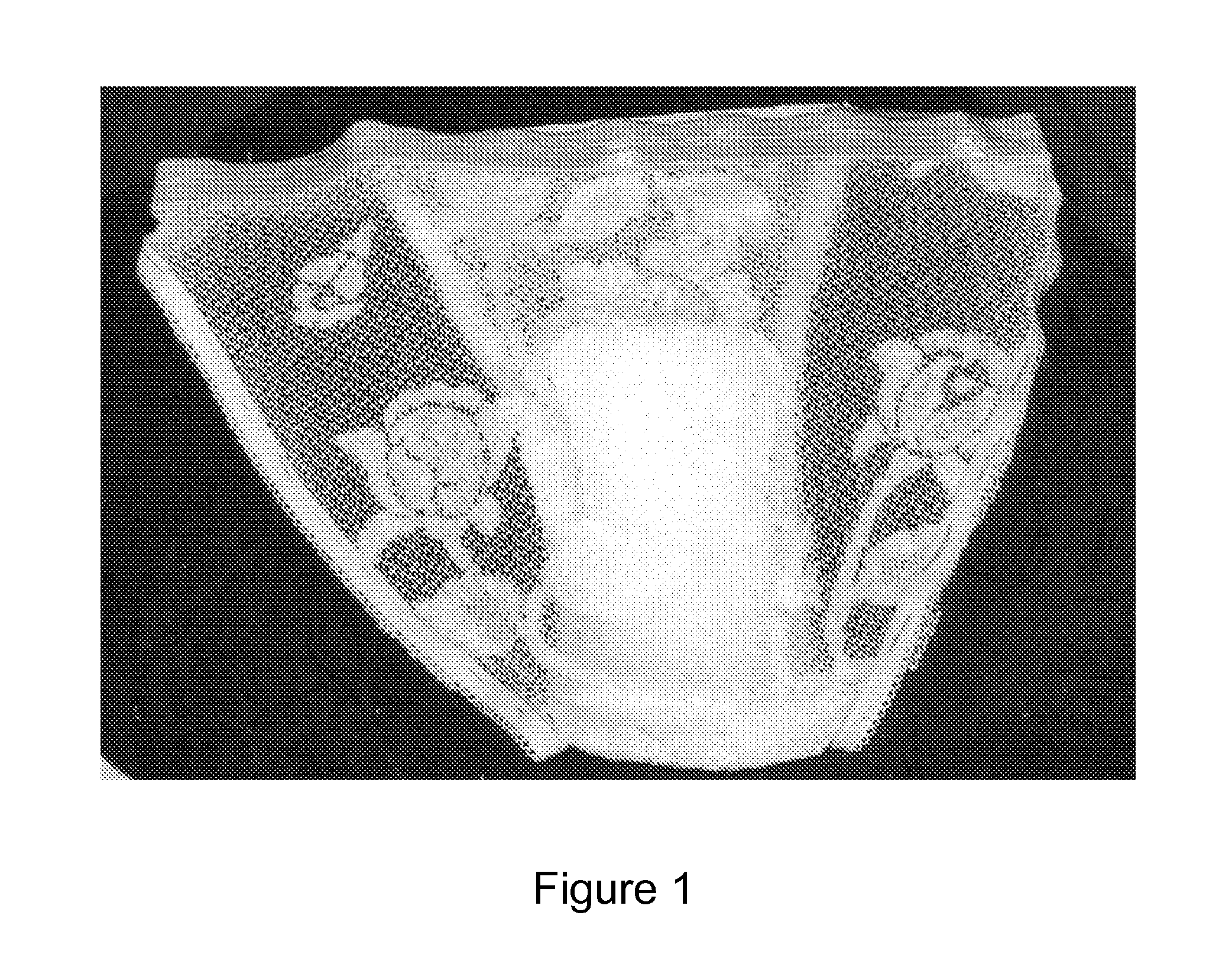 Undergarment incorporating integrated sanitary napkin