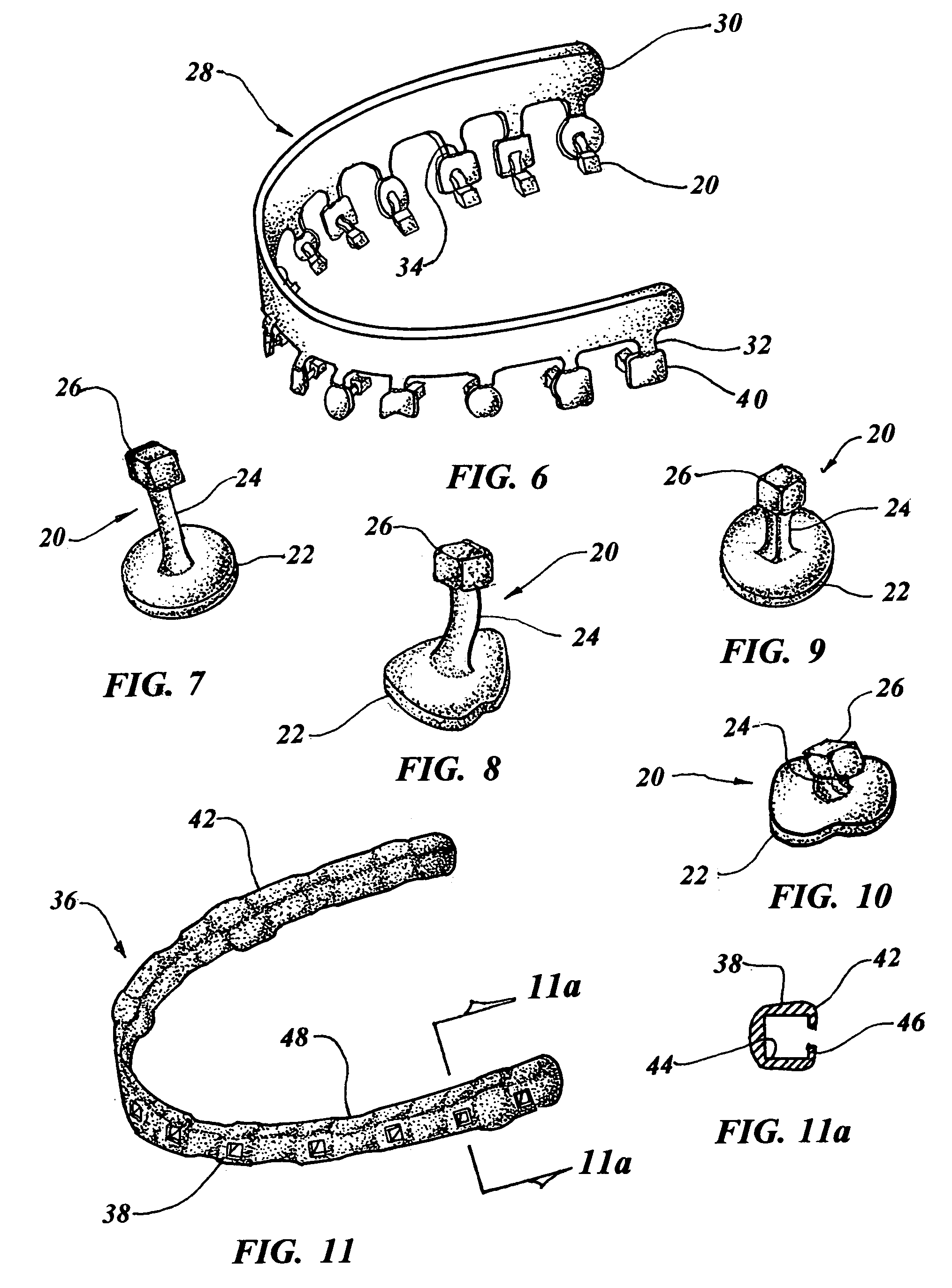 Computer configured appliance for orthodontic correction of malocclusions