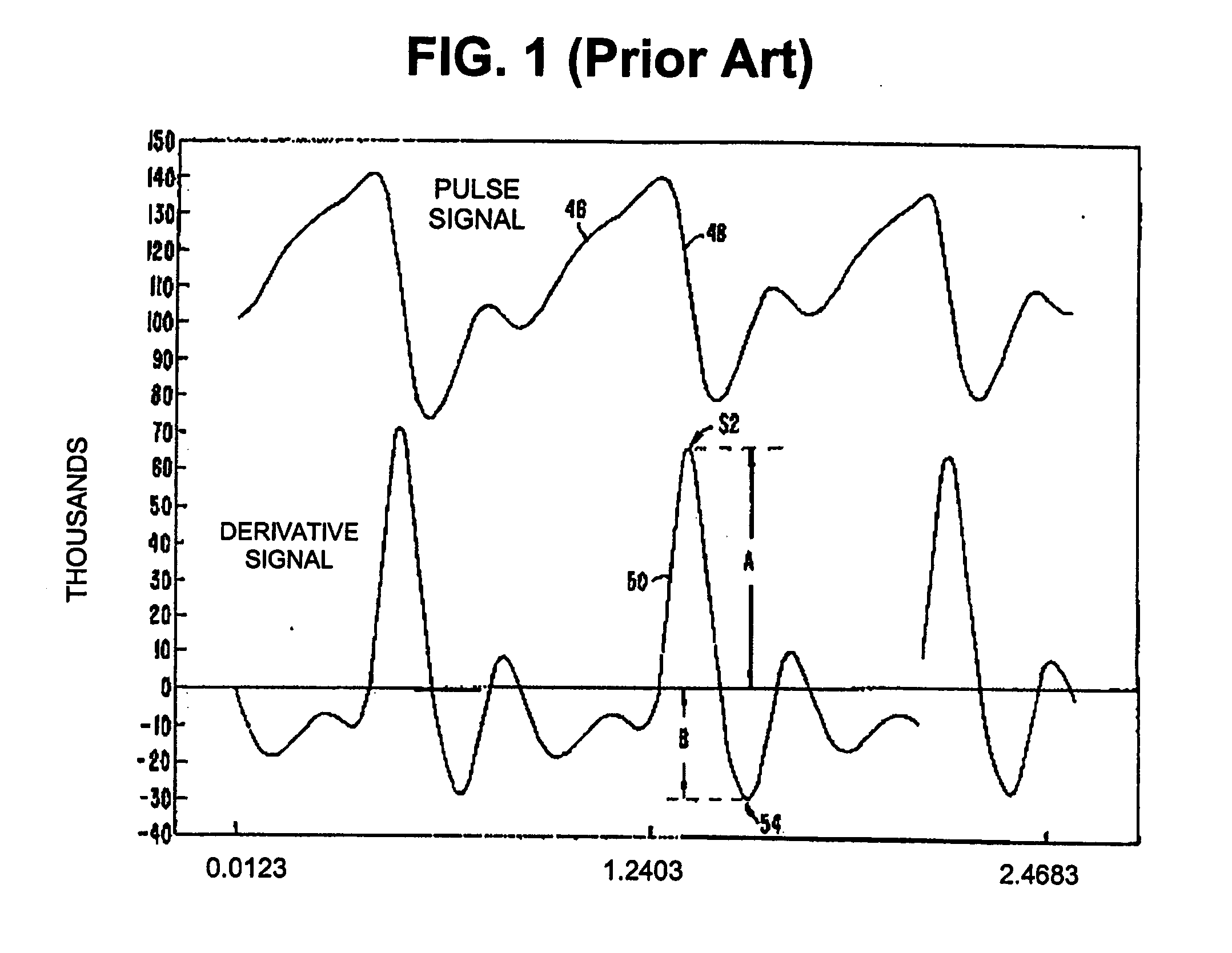 Apparatus and method for detecting blood flow signal free from motion artifact and stress test apparatus using the same