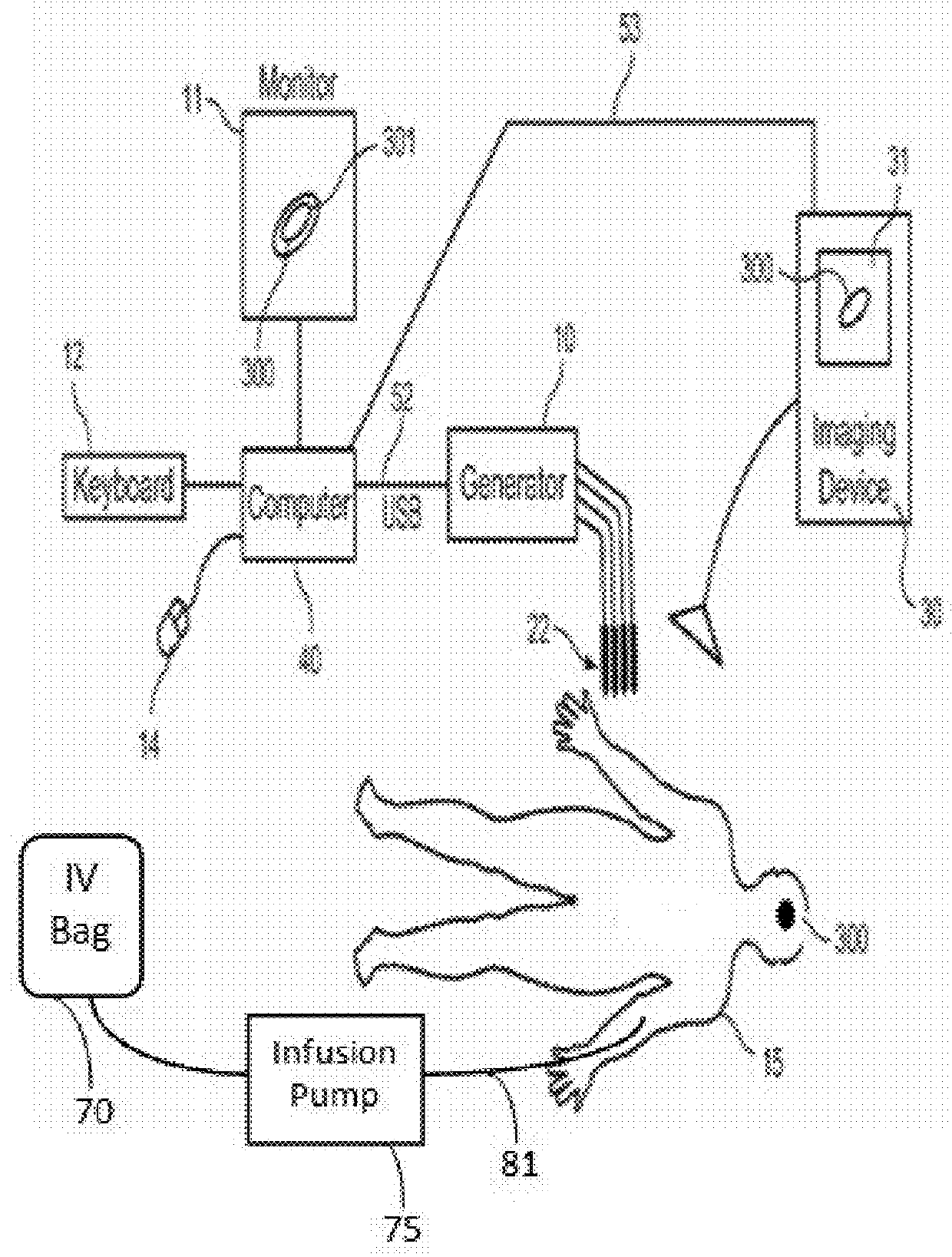 Immunotherapeutic methods using irreversible electroporation