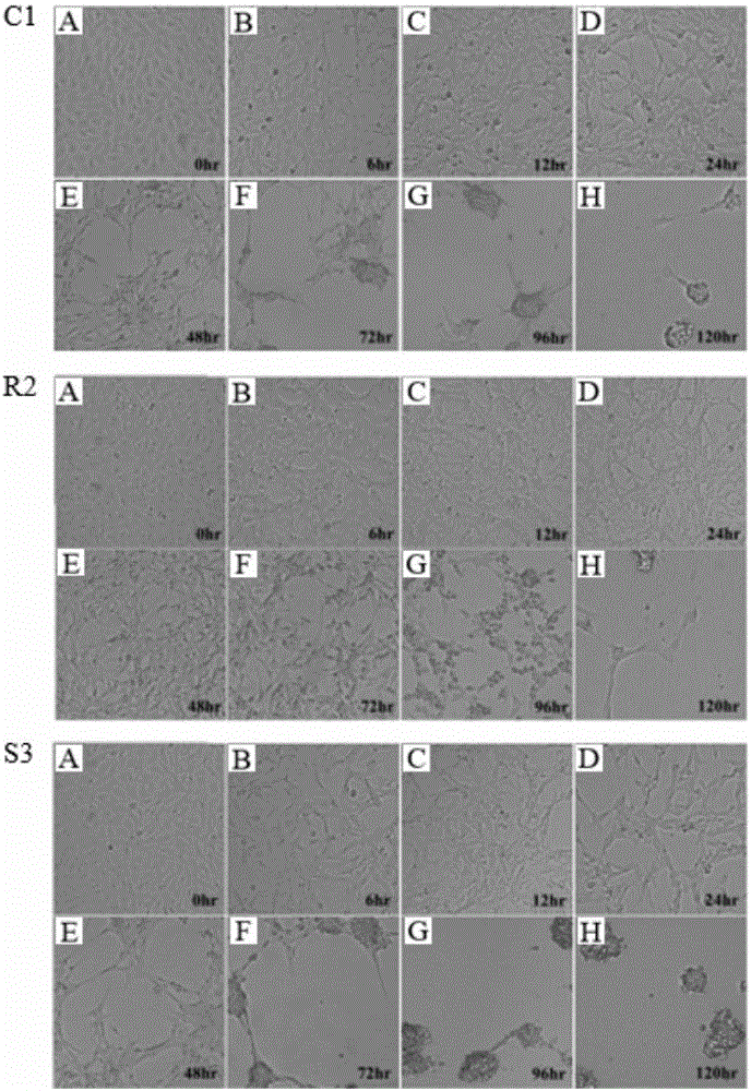 Genetic marker-related with immunity traits of hemorragic disease of grass carp