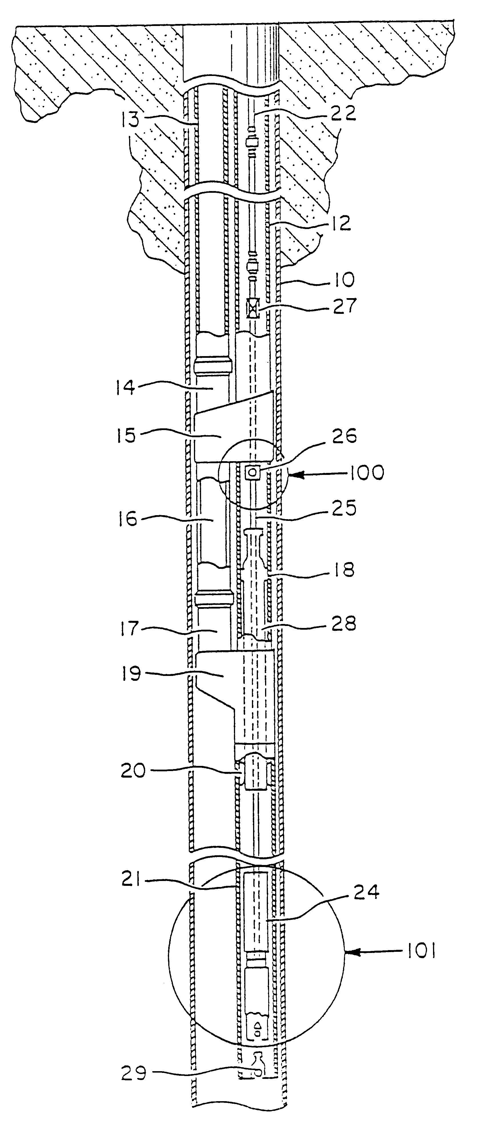 Pump systems and methods