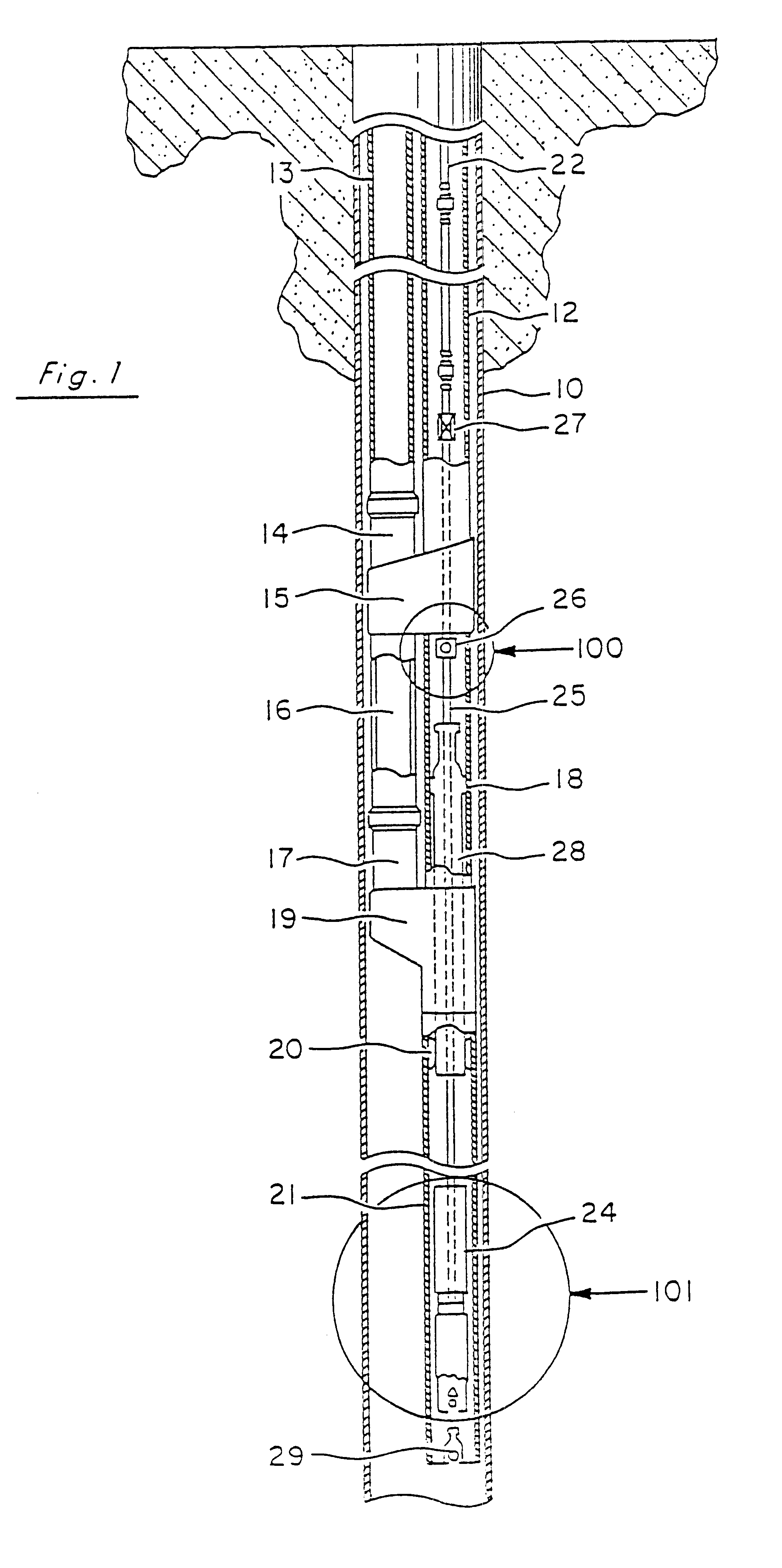 Pump systems and methods