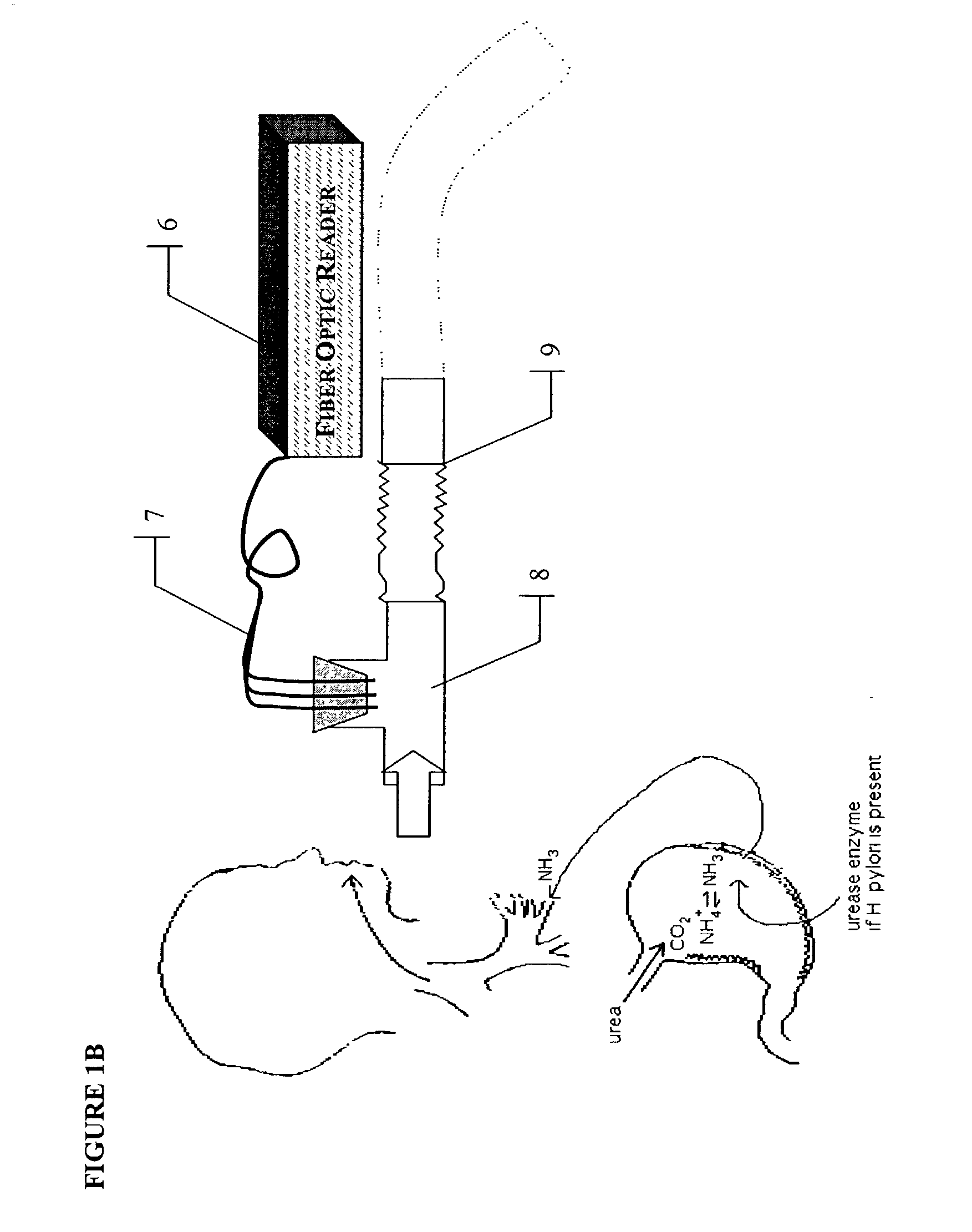 Method for diagnosis of helicobacter pylori infection