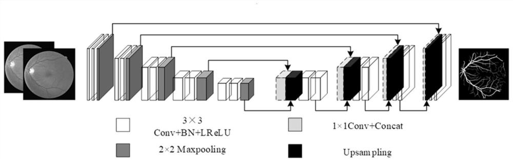 Multichannel retinal vessel image segmentation method based on U-net network