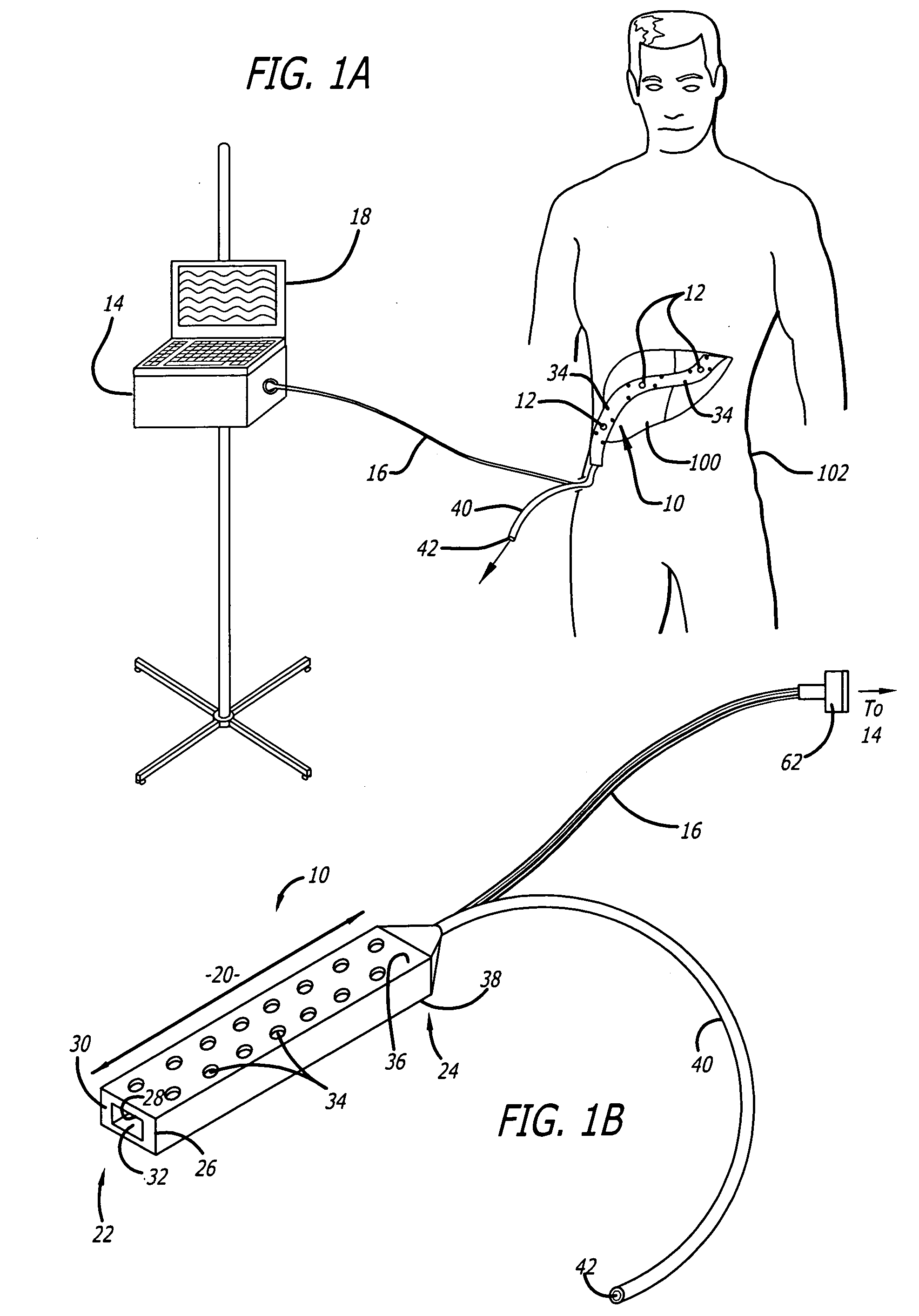 Surgical drain with sensors for monitoring internal tissue condition by transmittance
